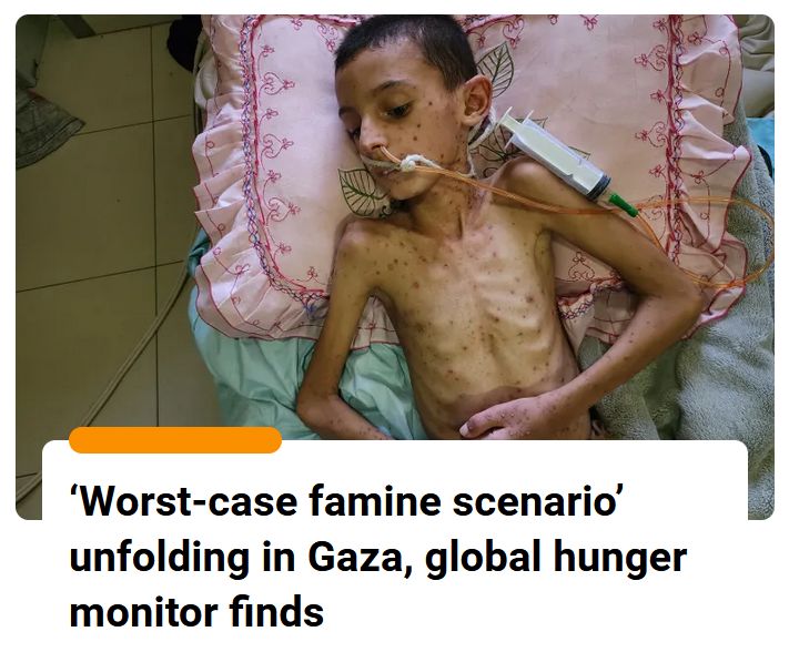 Image of an emaciated child in Gaza, Al-Jazeera, 29 July 2025